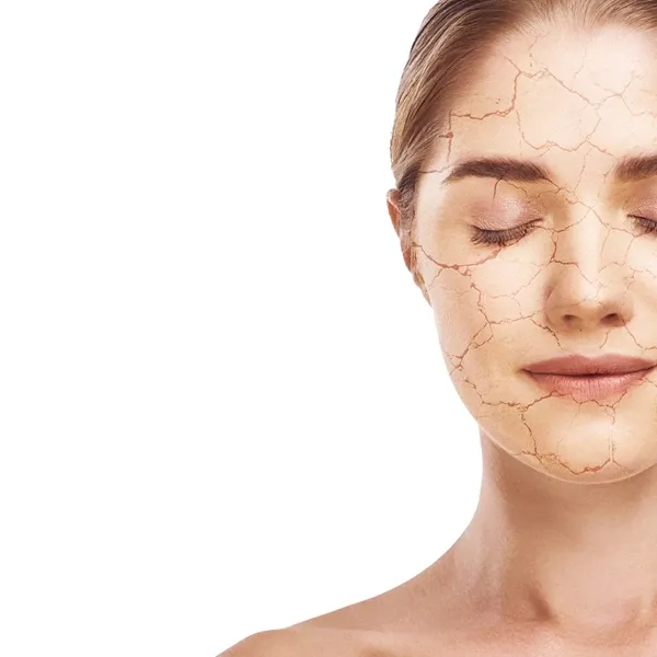 Woman with dry skin on face