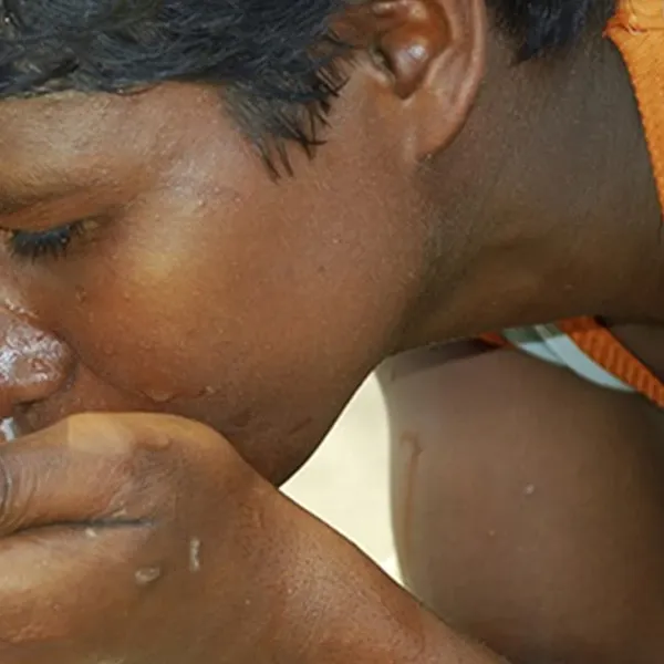 Waterborne Diseases