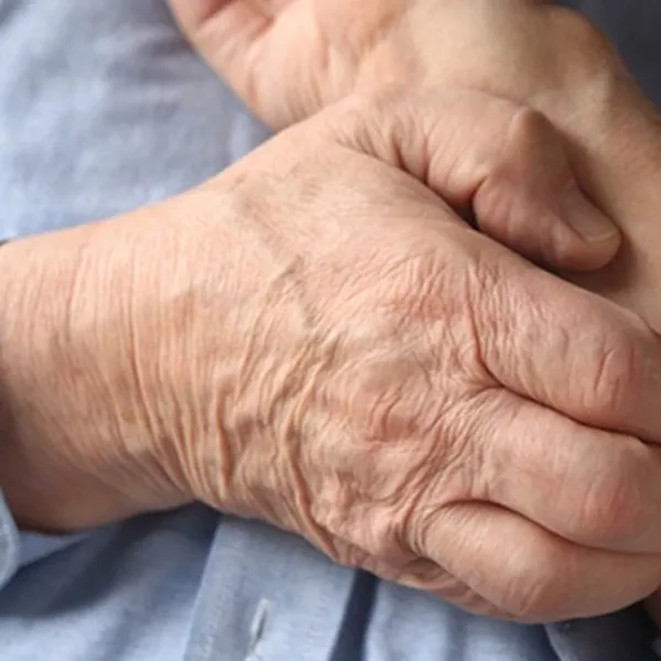 Skin Infections